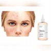 THE ORDINARY TONIK Z KWASEM GLIKOLOWYM ALOES Toning Solution 7% 240 ml