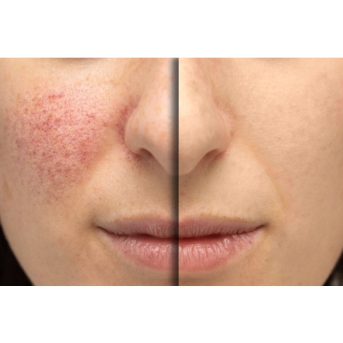 THE ORDINARY AHA 30% + BHA 2% Peeling Kwasowy 30ml