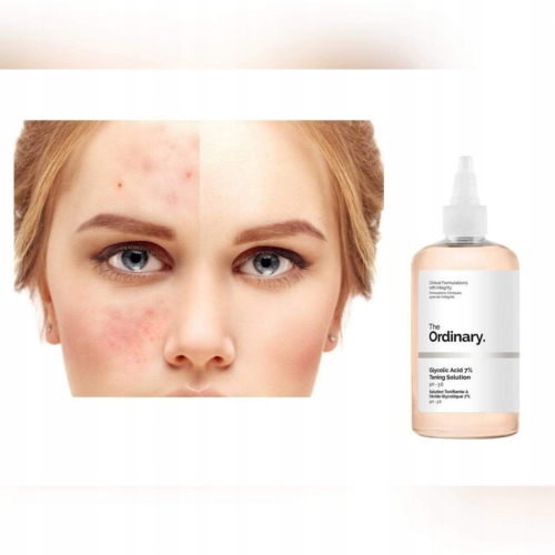 THE ORDINARY TONIK Z KWASEM GLIKOLOWYM ALOES Toning Solution 7% 240 ml